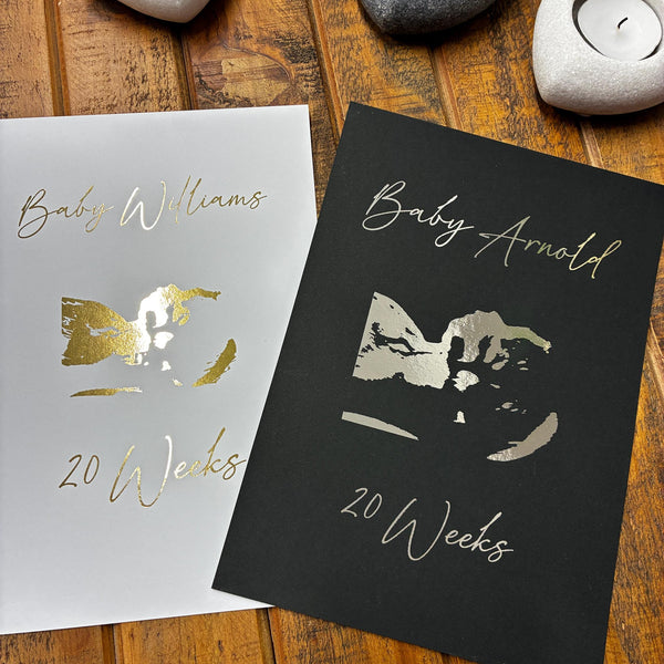 Personalised Ultrasound Keepsake Print in Gold/Silver Foil
