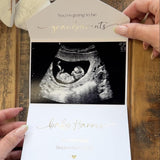 Gold Foil Scan Photo Pregnancy Reveal Card, Personalised Baby Announcement Keepsake